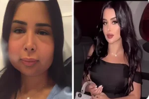  دانة الشهري قبل عمليات التجميل وبعده