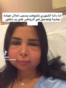 دانة الشهري قبل عمليات التجميل وبعده  دانة الشهري قبل عمليات التجميل وبعده